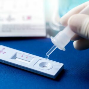 Antigen Schnelltestung